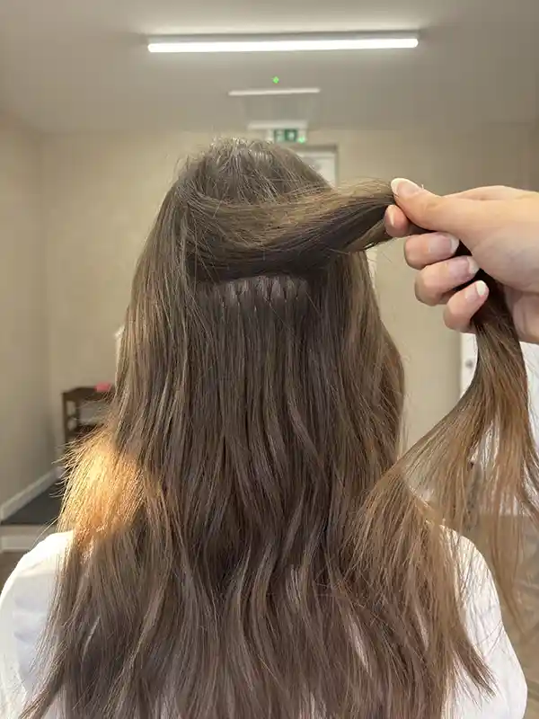 Gentle extensions for weight loss hair loss