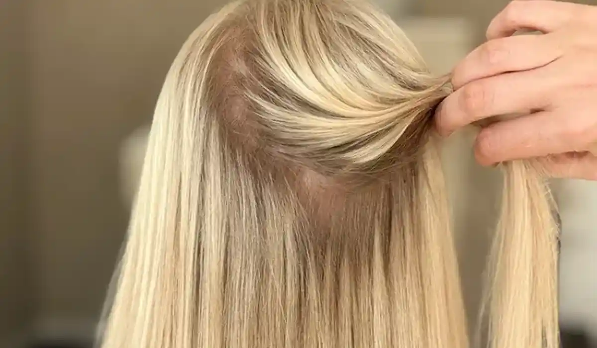 Thin Hair Transformation: A Keratin Bond Case Study